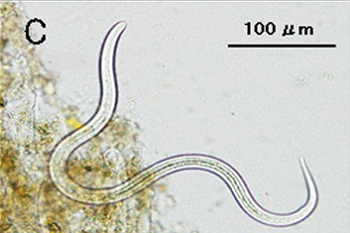 strongyloides larvae