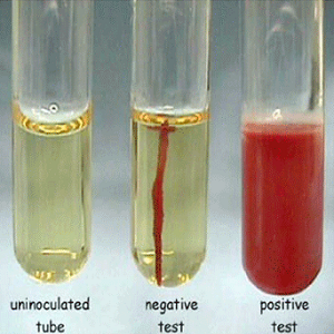 Motility Culture Method - Introduction, Flagella, Fibril, Principle ...