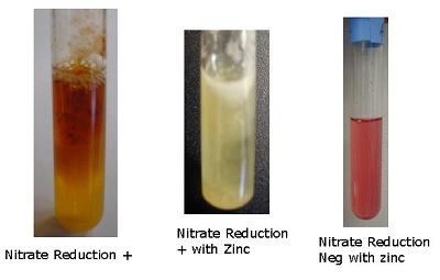 Nitrate Reduction Test - Principle, Biochemistry, Reagent, Procedure,  Result, Interpretation